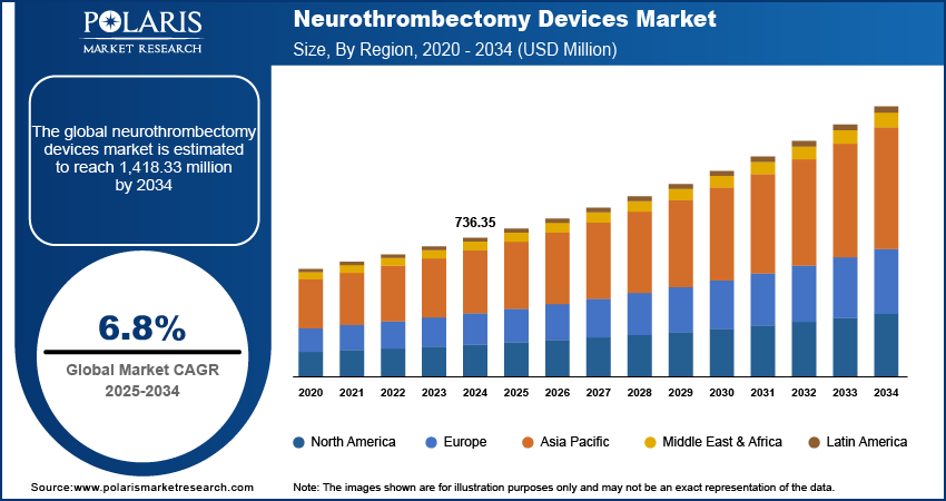 Neurothrombectomy Devices Market Size